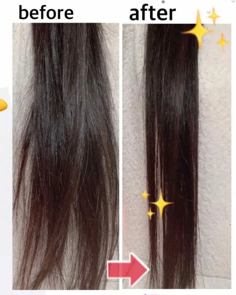 Fino before and after results
